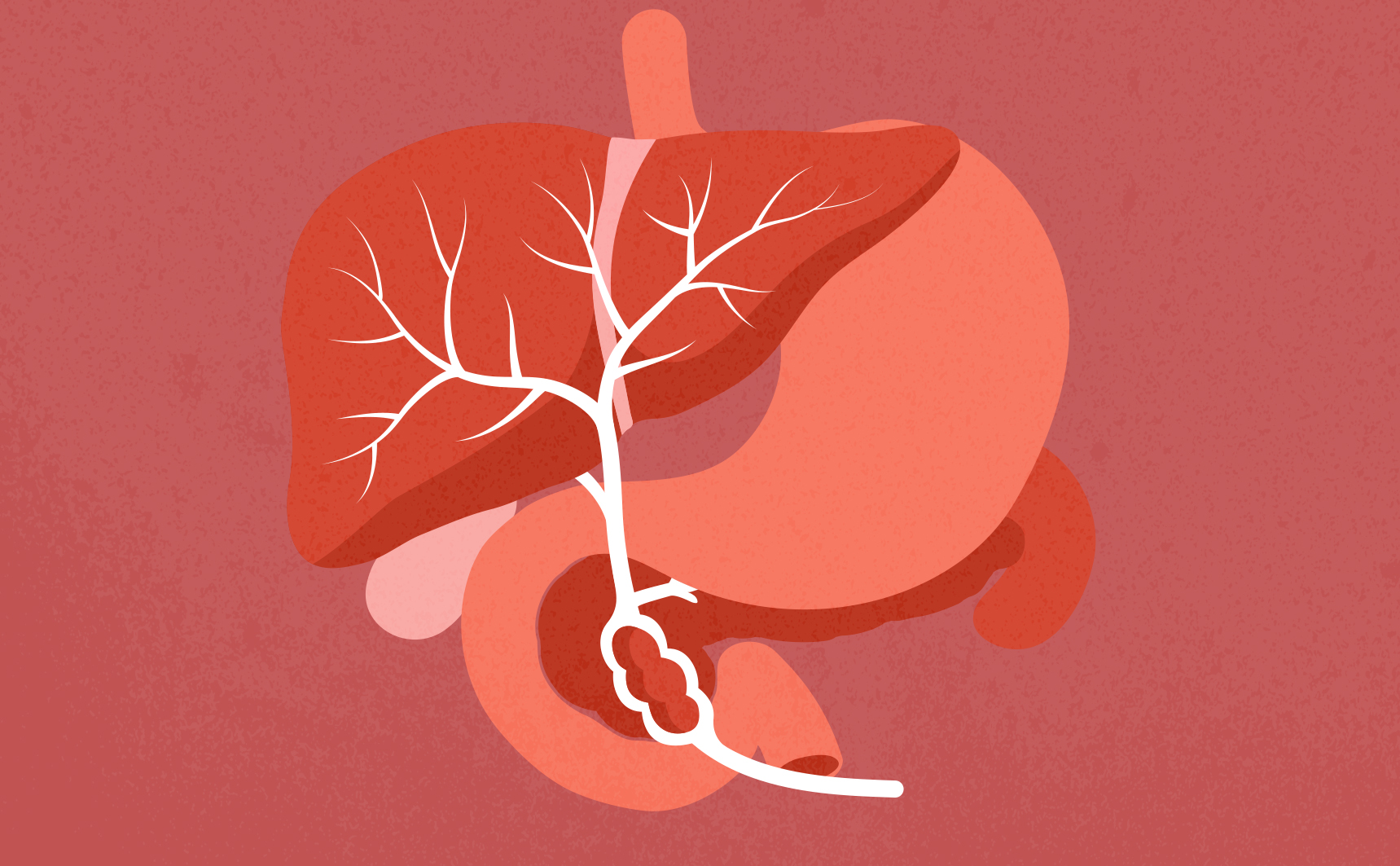 Maladies des vaisseaux du foie : quand le flux sanguin se dérègle