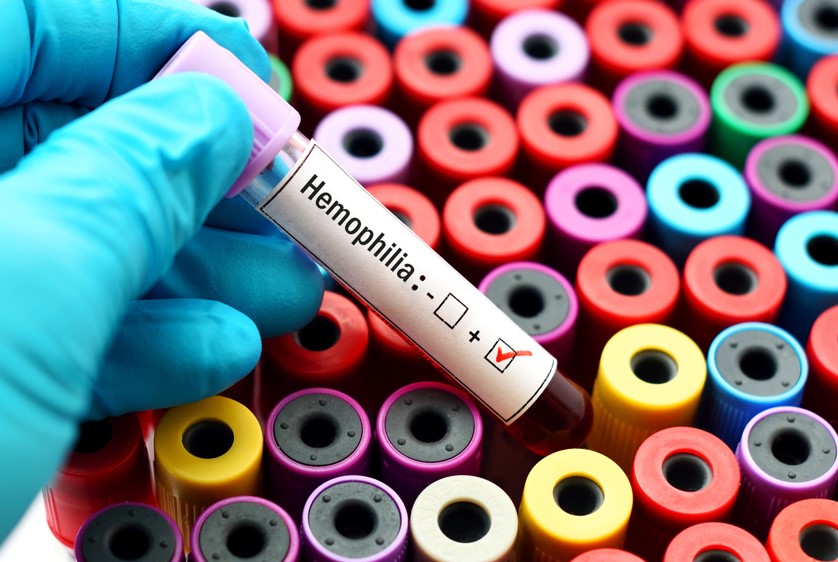 Vrai/faux sur l'hémophilie