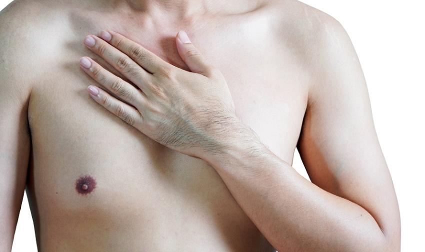 Les hommes sont aussi touchés par le cancer du sein - Prévention ...