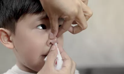 Vrai/faux sur les saignements de nez