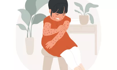 Scarlatine : fièvre, angine et éruption cutanée