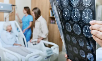 AVC : quelles sont les idées reçues sur les causes et les symptômes ?