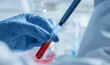 Hémochromatose : quand l’organisme accumule trop de fer