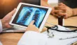 Dépistage du cancer du poumon : pourquoi et comment participer au programme IMPULSION ?