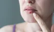 Comment reconnaître et traiter l’herpès labial ?